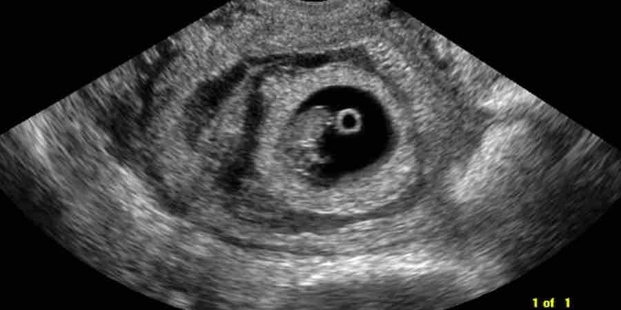 RNN Baby Name Generator